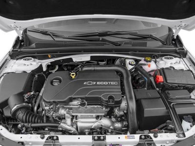 2017 Chevrolet Malibu 1LT